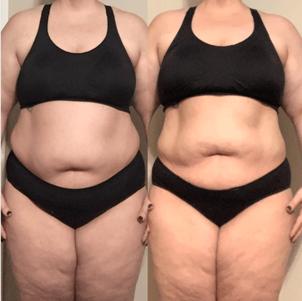 Customer before and after using the Exoh red light therapy belt