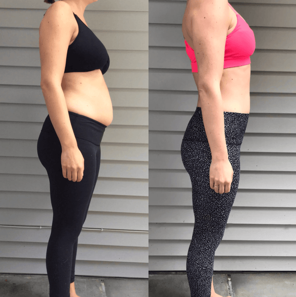Customer before and after using the Exoh red light therapy belt
