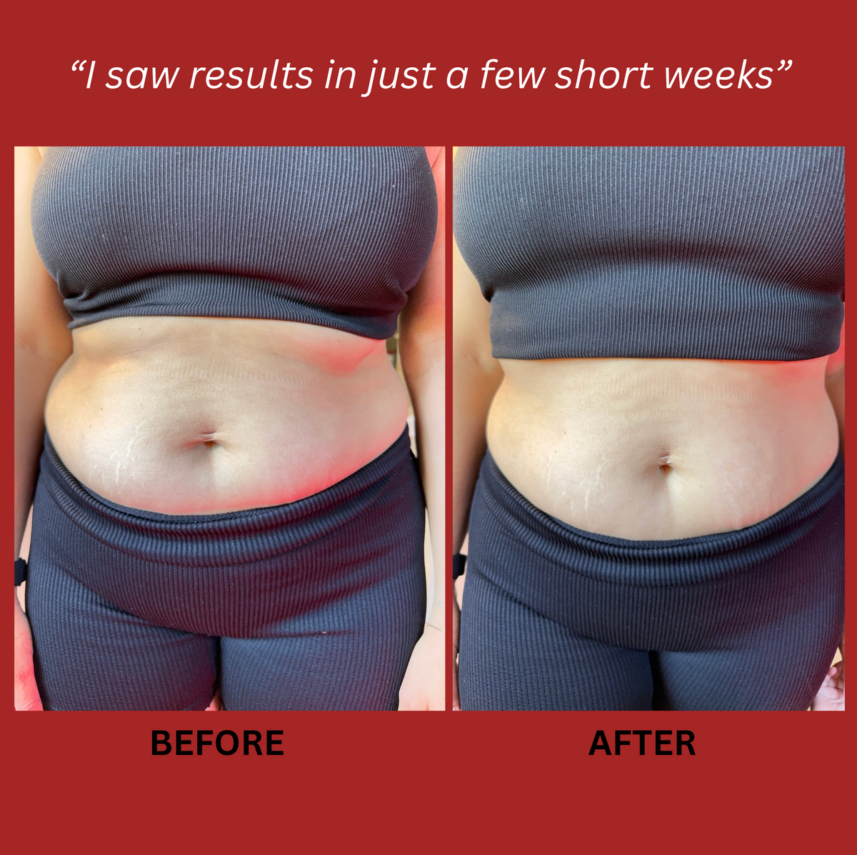 Exoh™ Red Light Therapy Belt
